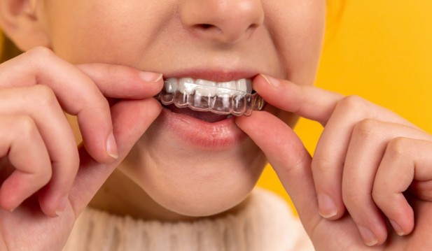How Carbamide Peroxide Whitens Teeth