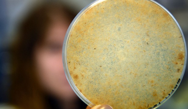 Rare Fungus Kills Wisconsin Woman; How Dangerous Is It? 