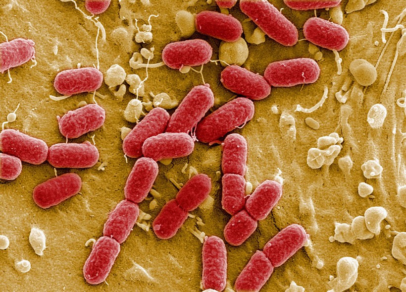 New Anti-Anti-Resistant Bacteria Antibiotics Discovered by AI! First One in Over 60 Years