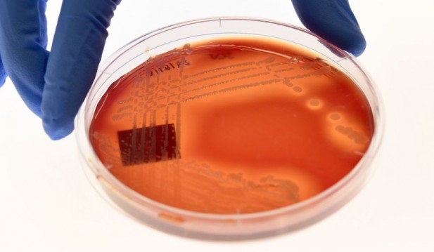 New Anti-Anti-Resistant Bacteria Antibiotics Discovered by AI! First One in Over 60 Years