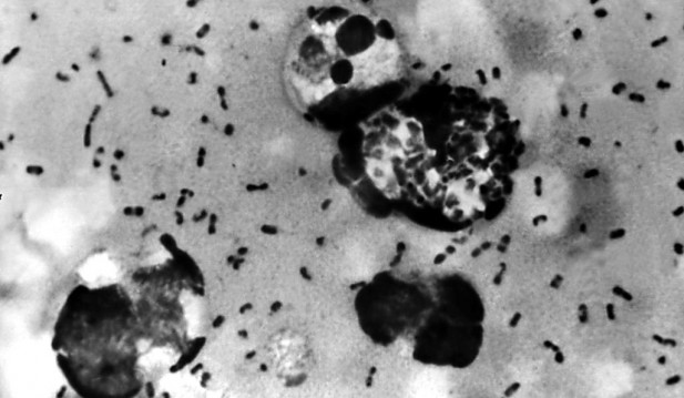 Bubonic Plague Kills NM Man --- Here's Some Information About Medieval Era Disease