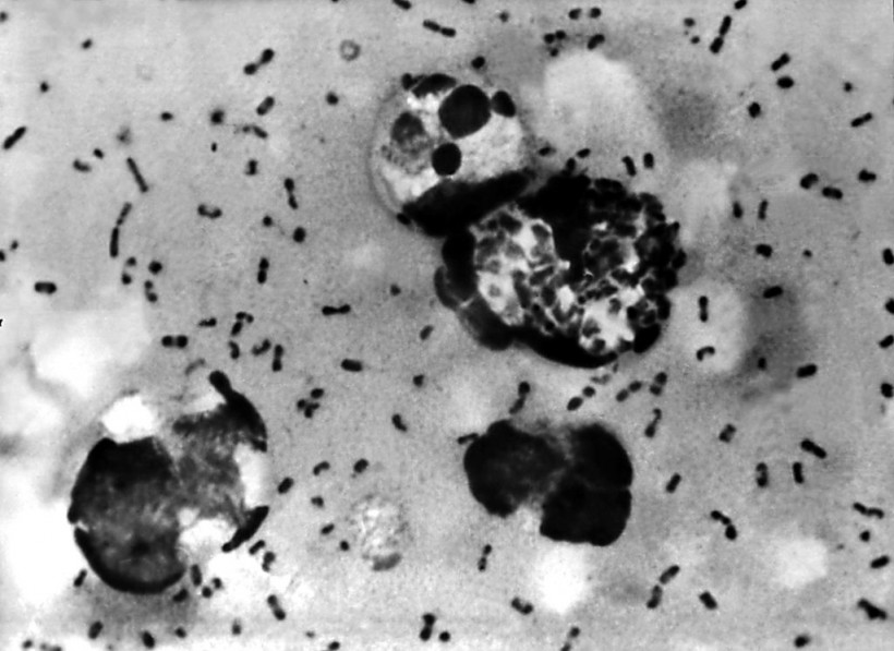 Bubonic Plague Kills NM Man --- Here's Some Information About Medieval Era Disease