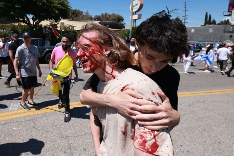 A man hugs a bloody supporter of Israel who clashed with pro-Palestinian protesters outside the Adas Torah synagogue in Los Angeles on Sunday, June 23, 2024.